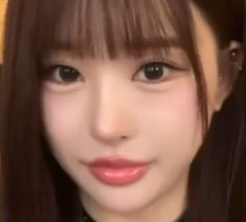 术后