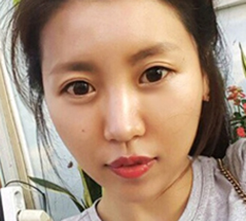 术后