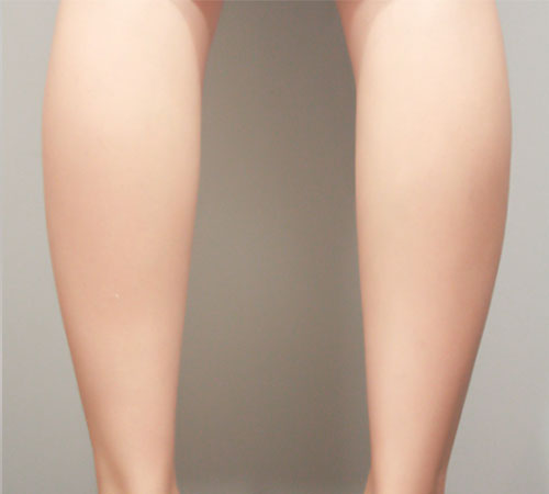 术后
