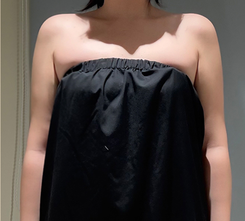 术后