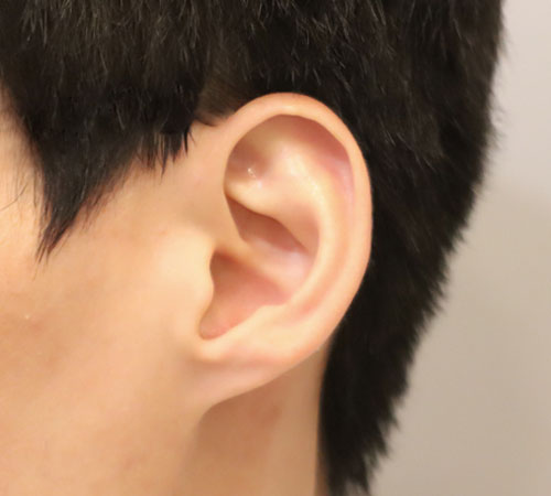 术前