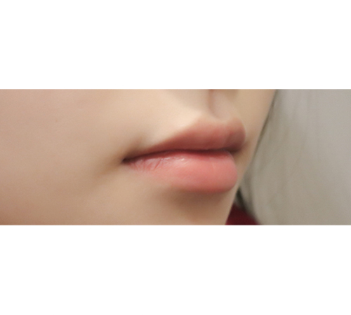 术前