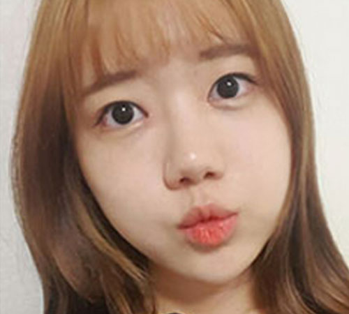 术后