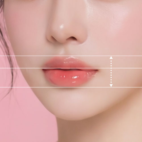 입술&입꼬리 필러와 보톡스 이미지