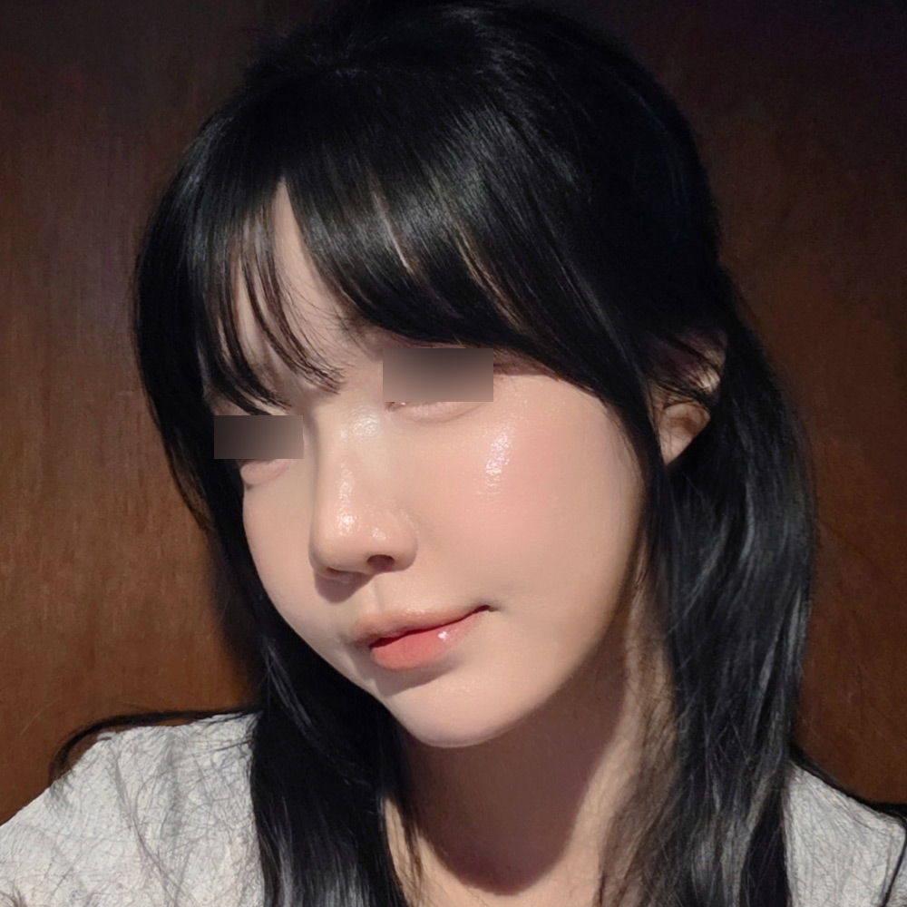 术后